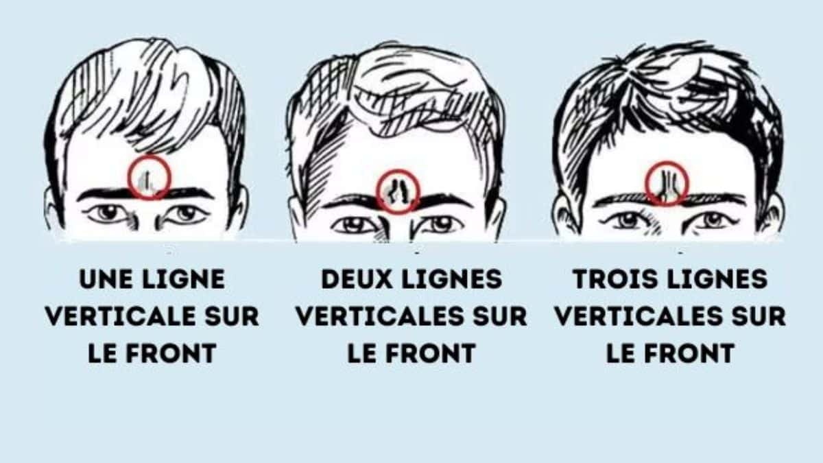 Test de personnalité : les rides de votre front en disent long sur votre caractère